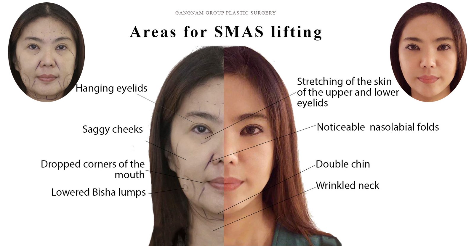 Anti-aging - 4 -2