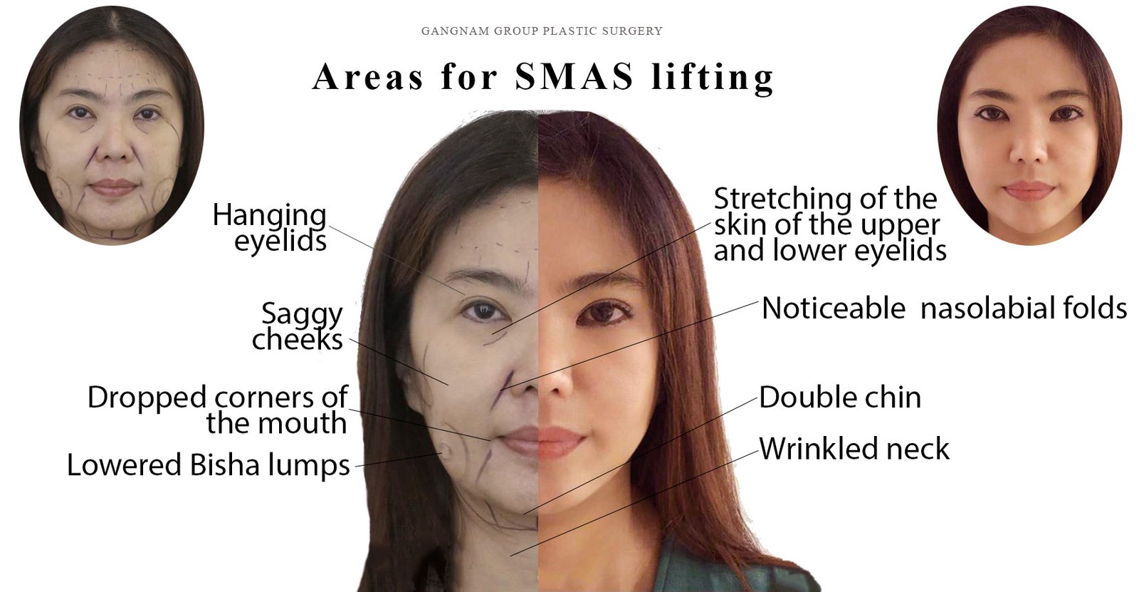 Anti-aging - 4