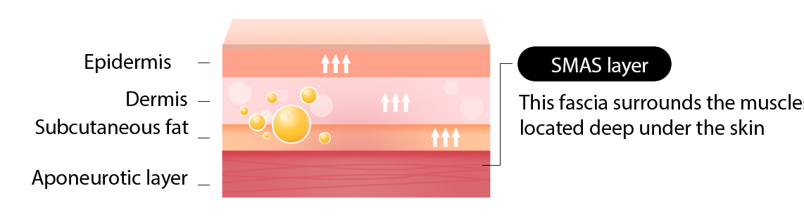 Anti-aging - mob 3