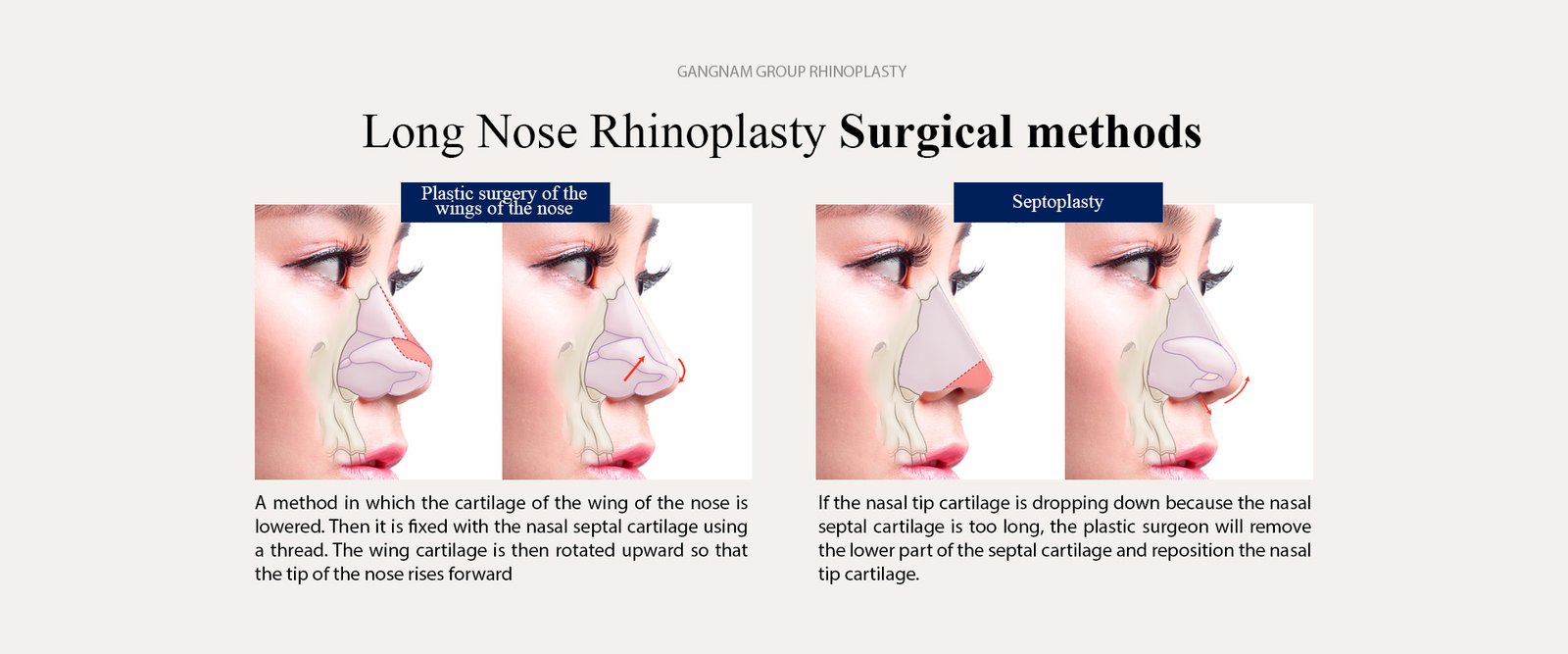 Long Nose