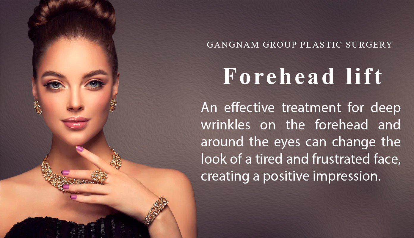 forehead lift - mob